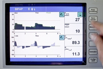 Beatmungsmonitoring Beatmungsmonitoring